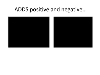 ADDS positive and negative..
 