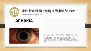 • Presented by – Ashith Tripathi (B. Optom)
• Guided by – Mr. Gaurav Dubey Sir ( M.
Optom, Faculty at UPUMS, Saifai, Etawah, U.
P.)
 