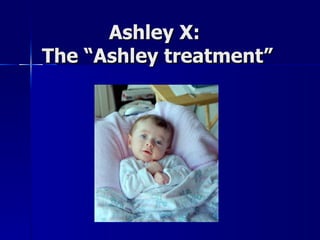 Ashley X:  The “Ashley treatment” 