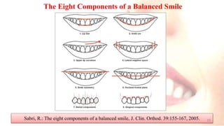 The Eight Components of a Balanced Smile
Sabri, R.: The eight components of a balanced smile, J. Clin. Orthod. 39:155-167, 2005. 10
 