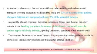• Ackerman et.al observed that the main differences between treated and untreated
teenagers were the intercanine width and the smile arc; 33% of the orthodontic patients
showed a flattened arc, compared with only 5% of the untreated patients.
• Because the clinical crowns of the upper canines are longer than those of the other
anterior teeth, bonding brackets at the centers of the clinical crowns will make the
canines appear relatively extruded, spoiling the natural curvature of the anterior teeth.
• The common focus on extrusion of the maxillary canines for canine guidance results in
intrusion of the maxillary incisors and thus creates a flatter smile arc.
A morphometric analysis of the posed smile, Clin. Orthod res. Ackerman et al-1998.
15
 