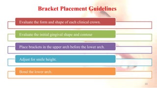 Bracket Placement Guidelines
Evaluate the form and shape of each clinical crown.
Evaluate the initial gingival shape and contour
Place brackets in the upper arch before the lower arch.
Adjust for smile height.
Bond the lower arch.
20
 