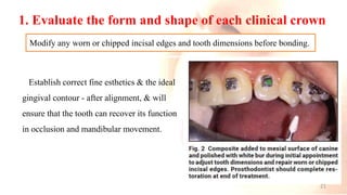 1. Evaluate the form and shape of each clinical crown
Establish correct fine esthetics & the ideal
gingival contour - after alignment, & will
ensure that the tooth can recover its function
in occlusion and mandibular movement.
Modify any worn or chipped incisal edges and tooth dimensions before bonding.
21
 