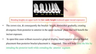• The crown size, & consequently the bracket height, diminishes gradually, creating
divergence from posterior to anterior in the upper occlusal plane that will benefit the
incisor exposure.
• In open-bite cases without excessive gingival display, more superior anterior bracket
placement than posterior bracket placement is suggested. This will help close the bite by
intruding the posterior teeth while extruding the anterior segment.
Bonding heights on upper teeth for low smile height (reduced upper incisal exposure).
24
 
