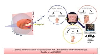 Bracket placement based on smile esthetics | PPT