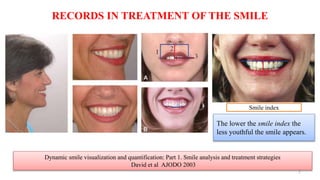 Bracket placement based on smile esthetics | PPT