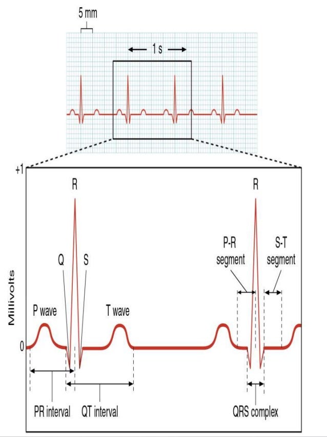 Physiology of ECG ,localisation of MI