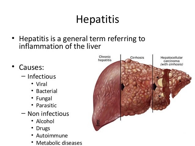 Hepatitis Bei Erwachsenen Symptomes