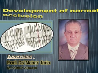 Supervision :
Prof. Dr/ Maher foda
By / Ashraf Almassri
 