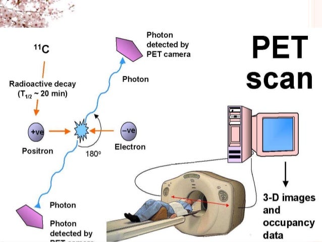 positron emission tomography imaging of drug induced tumor how a pet scan works