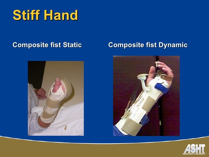 Asht ca chapter splinting
