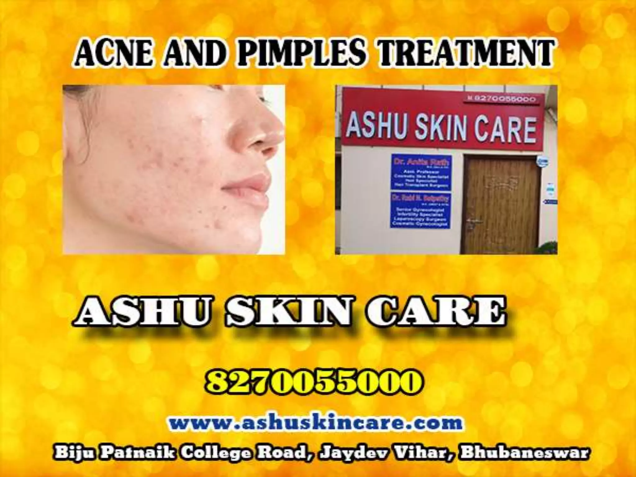 Ashu skin care best skin care clinic & hair transplant clinic in