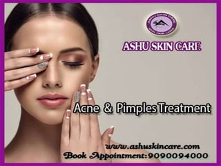 Ashu skin care is one of   the best  acne and pimples clinic in bhubaneswar, odisha.