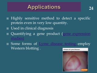  Highly sensitive method to detect a specific
protein even in very low quantity.
 Used in clinical diagnosis
 Quantifying a gene product (gene expression
studies)
 Some forms of Lyme disease testing employ
Western blotting .
24
 