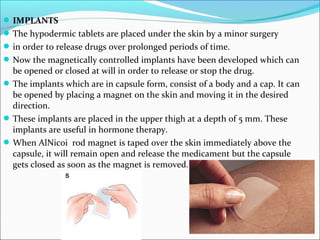 IMPLANTS
The hypodermic tablets are placed under the skin by a minor surgery
in order to release drugs over prolonged periods of time.
Now the magnetically controlled implants have been developed which can
be opened or closed at will in order to release or stop the drug.
The implants which are in capsule form, consist of a body and a cap. It can
be opened by placing a magnet on the skin and moving it in the desired
direction.
These implants are placed in the upper thigh at a depth of 5 mm. These
implants are useful in hormone therapy.
When AlNicoi rod magnet is taped over the skin immediately above the
capsule, it will remain open and release the medicament but the capsule
gets closed as soon as the magnet is removed.
 
