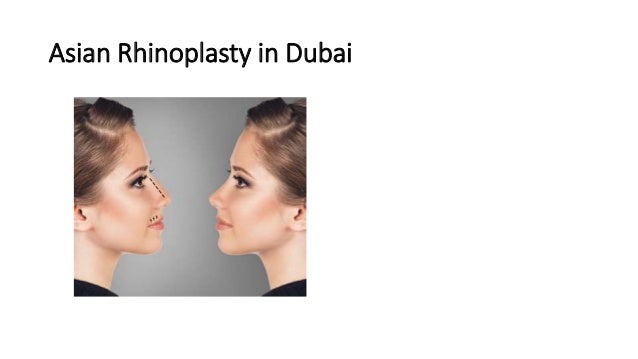 Asian rhinoplasty in dubai | PPT