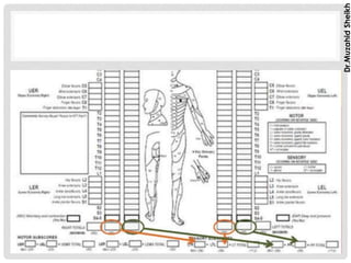 ASIA SCALE FOR SPINAL CORD INJURY ASSESSMENT | PDF