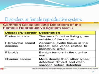 Disorders in female reproductive system:
30
 