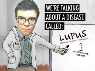 Asif lupuspresentation