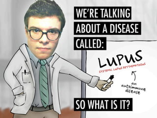 Asif lupuspresentation