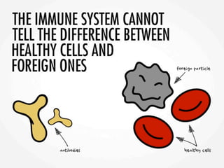 Asif lupuspresentation