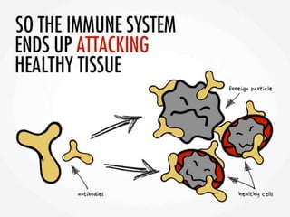 Asif lupuspresentation