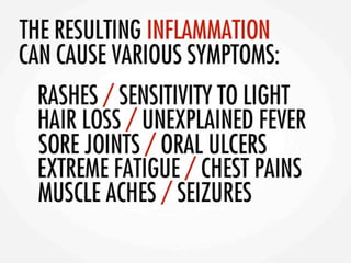 Asif lupuspresentation