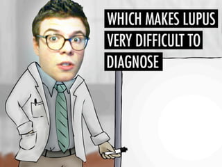 Asif lupuspresentation