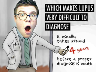 Asif lupuspresentation