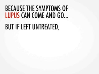 Asif lupuspresentation