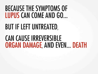 Asif lupuspresentation