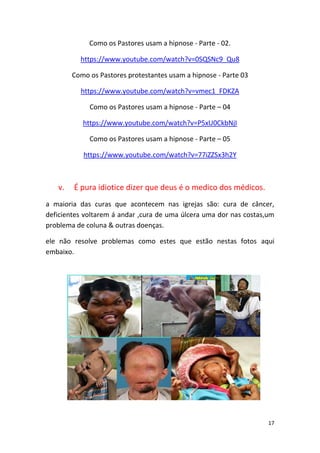 17
Como os Pastores usam a hipnose - Parte - 02.
https://www.youtube.com/watch?v=0SQSNc9_Qu8
Como os Pastores protestantes usam a hipnose - Parte 03
https://www.youtube.com/watch?v=vmec1_FDKZA
Como os Pastores usam a hipnose - Parte – 04
https://www.youtube.com/watch?v=P5xU0CkbNjI
Como os Pastores usam a hipnose - Parte – 05
https://www.youtube.com/watch?v=77iZZSx3h2Y
v. É pura idiotice dizer que deus é o medico dos médicos.
a maioria das curas que acontecem nas igrejas são: cura de câncer,
deficientes voltarem á andar ,cura de uma úlcera uma dor nas costas,um
problema de coluna & outras doenças.
ele não resolve problemas como estes que estão nestas fotos aqui
embaixo.
 