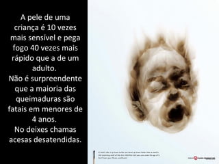 A pele de uma
criança é 10 vezes
mais sensível e pega
fogo 40 vezes mais
rápido que a de um
adulto.
Não é surpreendente
que a maioria das
queimaduras são
fatais em menores de
4 anos.
No deixes chamas
acesas desatendidas.
 
