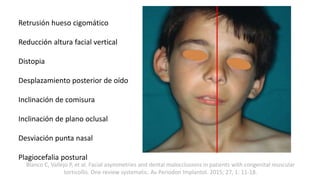 Vertical Distopia Asimetrías faciales | PPTX