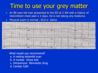 Time to use your grey matter




An 80 year-old man presented to the ED at 2 AM with a history of
intermittent chest pain x 2 days. He is not taking any medicine.
Physical exam is normal , ECG is below

What would you recommend?
a. A resting sistamibi scan
b. A nuclear stress test
c. Intravenous fibrinolytic drug
d. Cardiac Cath

 