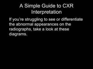A Simple Guide to CXR
Interpretation
If you’re struggling to see or differentiate
the abnormal appearances on the
radiographs, take a look at these
diagrams.
 