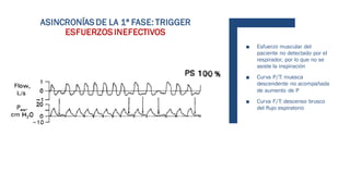 ■ Esfuerzo muscular del
paciente no detectado por el
respirador, por lo que no se
asiste la inspiración
■ Curva P/T: muesca
descendente no acompañada
de aumento de P
■ Curva F/T: descenso brusco
del flujo espiratorio
ASINCRONÍAS DE LA 1ª FASE: TRIGGER
ESFUERZOS INEFECTIVOS
 