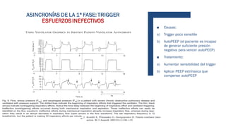 ■ Causas:
a) Trigger poco sensible
b) AutoPEEP (el paciente es incapaz
de generar suficiente presión
negativa para vencer autoPEEP)
■ Tratamiento:
a) Aumentar sensibilidad del trigger
b) Aplicar PEEP extrínseca que
compense autoPEEP
ASINCRONÍAS DE LA 1ª FASE: TRIGGER
ESFUERZOSINEFECTIVOS
 