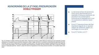 ■ La demanda de flujo del paciente es
mayor que la administrada por el
respirador. El esfuerzo inspiratorio del
paciente no es compensado lo
suficiente por el respirador por lo que
no se presuriza el sistema y cae la
presión
■ Curva F/T: descenso brusco del flujo
inspiratorio seguido de un ascenso
(disparo de asistencia), dando una
morfología a la curva de M
■ Curva P/T similar a la F/T
ASINCRONÍAS DE LA 2ª FASE: PRESURIZACIÓN
DOBLETRIGGER
 