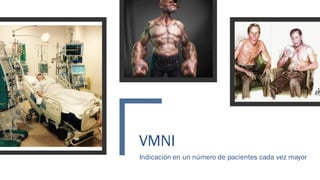 VMNI
Indicación en un número de pacientes cada vez mayor
 