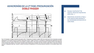 ASINCRONÍAS DE LA 2ª FASE: PRESURIZACIÓN
DOBLETRIGGER
■ Causas: insuficiente P de
soporte, esfuerzos inspiratorios
extra (tos,...)
■ Tratamiento: Aumentar el flujo y
P de soporte hasta ajustarlo a
las necesidades del paciente en
cada etapa
 