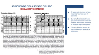 ■ El respirador termina la fase
inspiratoria antes que el
paciente
■ Curva P/T con caída brusca
que coincide con el cese del
soporte ventilatorio mientras
el paciente sigue inspirando
■ Curva F/T Caída brusca de
flujo inspiratorio pasando a
espiración
ASINCRONÍAS DE LA 3ª FASE: CICLADO
CICLADO PREMATURO
 
