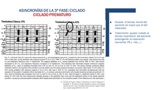 ASINCRONÍAS DE LA 3ª FASE: CICLADO
CICLADO PREMATURO
■ Causas: el tiempo neural del
paciente es mayor que el del
respirador
■ Tratamiento: ajustar ciclado al
tiempo inspiratorio del paciente
prolongando la inspiración
(aumentar PS y rise,…)
 