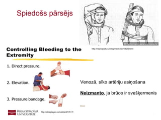 12
Spiedošs pārsējs
http://slideplayer.com/slide/217617/
Venozā, sīko artēriju asiņošana
Neizmanto, ja brūce ir svešķermenis
http://nepropadu.ru/blog/medicine/10620.html
 