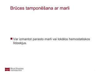15
 Var izmantot parasto marli vai lokālos hemostatiskos
līdzekļus.
Brūces tamponēšana ar marli
 