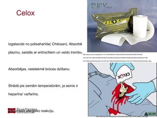 16
Celox
Izgatavots no polisaharīda( Chitosan). Absorbē
plazmu, saistās ar eritrocītiem un veido trombu.
Absorbējas, neietekmē brūces dzīšanu.
Strādā pie zemām temperatūrām, ja asinis ir
heparīns/ varfarīns.
Var izraisīt alerģisko reakciju.
http://www.surv24.ru/blogs/2014/11/21/%D0%BA%D1%80%D0%BE%D0%B2%D0%BE%D0%BE
%D1%81%D1%82%D0%B0%D0%BD%D0%B0%D0%B2%D0%BB%D0%B8%D0%B2%D0%B0%D1%8E
%D1%89%D0%B5%D0%B5-%D1%81%D1%80%D0%B5%D0%B4%D1%81%D1%82%D0%B2%D0%BE-celox/
http://www.surv24.ru/blogs/wp-content/uploads/2014/11/chto_takoe_celox.jpg
 