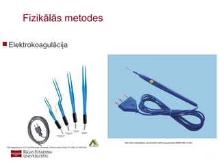 25
 Elektrokoagulācija
Fizikālās metodes
http://aggiewang.en.ec21.com/Disposable_Monopolar_Electrosurgical_Pencil--4713844_4713979.html
http://www.medicalexpo.com/prod/kls-martin-group/product-69026-446112.html
 