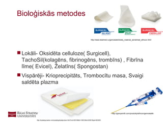 27
 Lokāli- Oksidēta celluloze( Surgicell),
TachoSil(kolagēns, fibrinogēns, trombīns) , Fibrīna
līme( Evicel), Želatīns( Spongostan)
 Vispārēji- Krioprecipitāts, Trombocītu masa, Svaigi
saldēta plazma
Bioloģiskās metodes
http://www.dealmed.ru/gemostaticheskij_material_serdzhisel_ethicon.html
http://granysmith.com/produkty/ethicon/gemostatiki
http://ecatalog.baxter.com/ecatalog/loadproduct.html?cid=20016&lid=10001&hid=20001&pid=823039
 