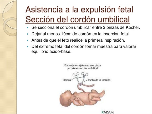 La máscara para los párpados de la uva