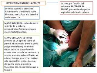 DESPRENDIMIENTO DE LA CABEZA La principal función del 
asistente: PROTEGER EL 
PERINÉ, para evitar desgarros 
vaginales o del suelo pélvico 
Se inicia cuando la cabeza se 
hace visible a través de la vulva. 
El obstetra se coloca a la derecha 
de la mujer con: 
MANO IZQUIERDA: sobre la parte 
saliente de la cabeza, 
presionándola firmemente para 
mantenerla flexionada 
MANO DERECHA: Se coloca 
provista de un apósito sobre el 
periné, abarcándolo entre el dedo 
pulgar de un lado y los demás 
dedos del otro, sosteniendo la 
cabeza para retardar su descenso y 
ayudar a mantenerla en flexión. Al 
mismo tiempo, se acercan hacia el 
rafe perineal los tejidos laterales 
del periné como si quisiera 
fruncirlos, con lo cual disminuye la 
tensión 
 